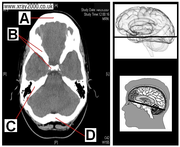 AXIAL SECTION 10.JPG